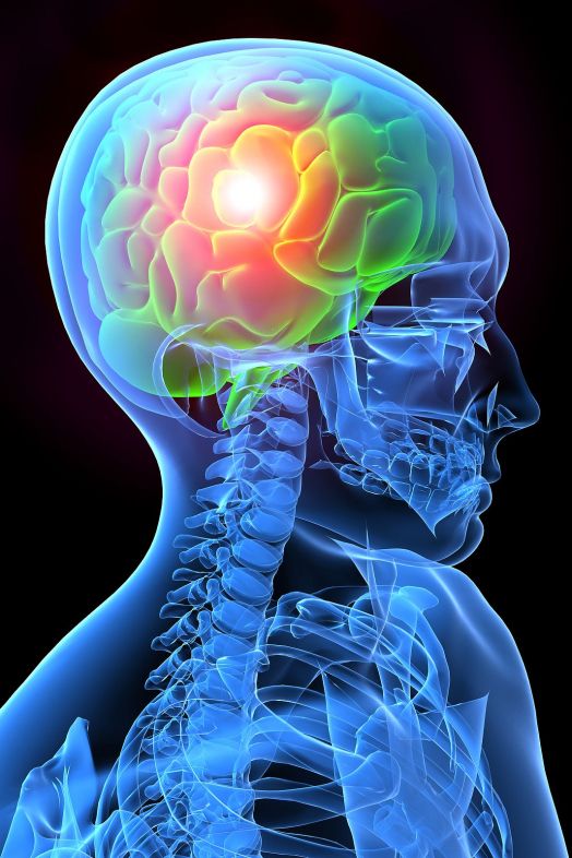 Migraña crónica : tratamiento y prevención (bigstock) Migraña crónica : tratamiento y prevención (bigstock)
