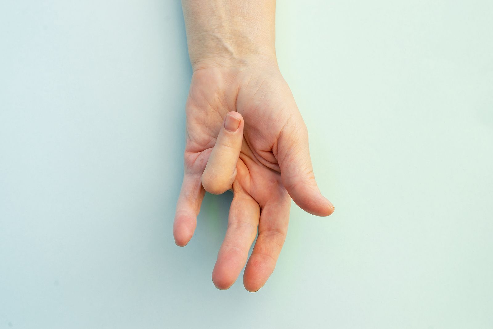 Enfermedad de Dupuytren, el trastorno de origen desconocido que afecta a nuestras manos (bigstock)