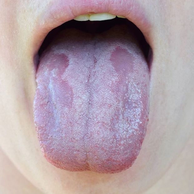 bigstock Atento a tu lengua y lo que dice de tu salud
