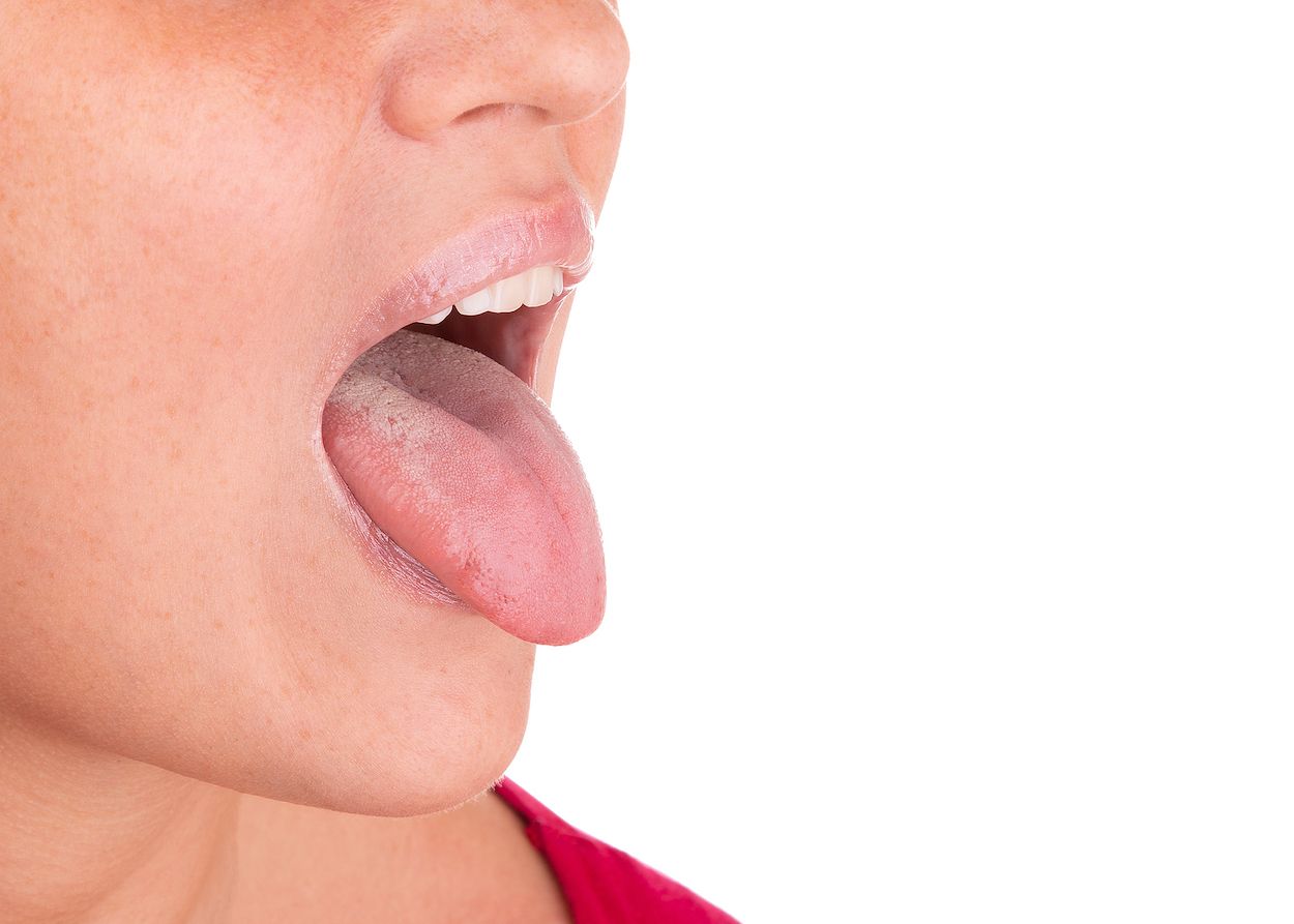 Atento a tu lengua y lo que dice de tu salud