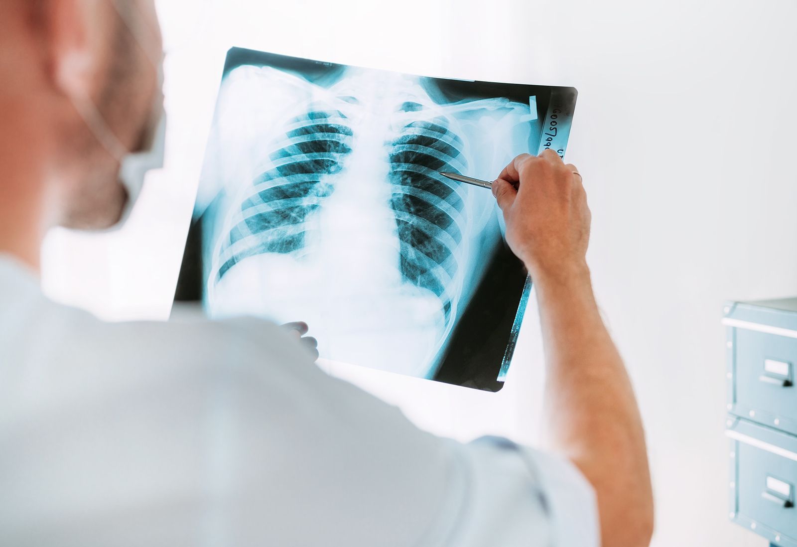 Tengo una mancha en el pulmón ¿qué puede ser?  Foto: bigstock