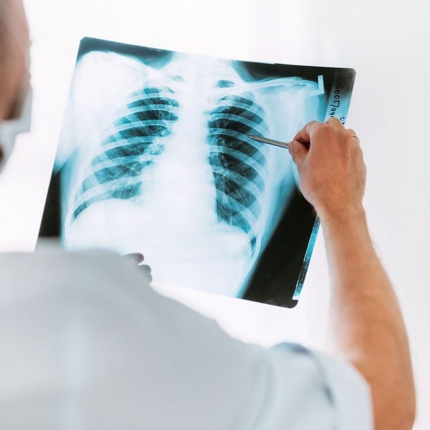 Tengo una mancha en el pulmón ¿qué puede ser?  Foto: bigstock