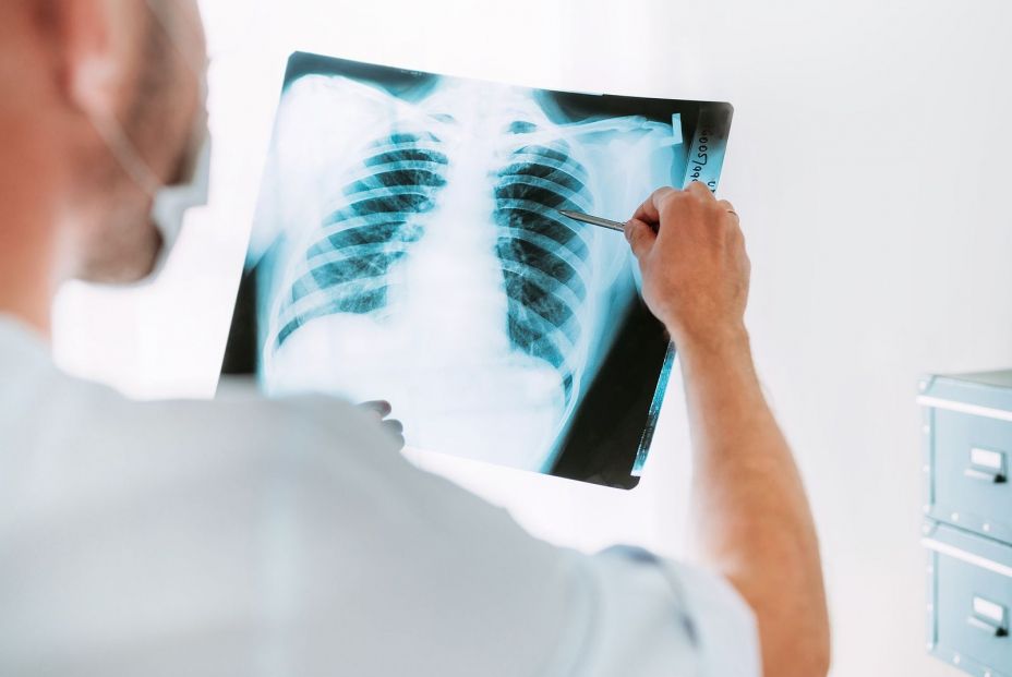 Tengo una mancha en el pulmón ¿qué puede ser?  foto: bigstock