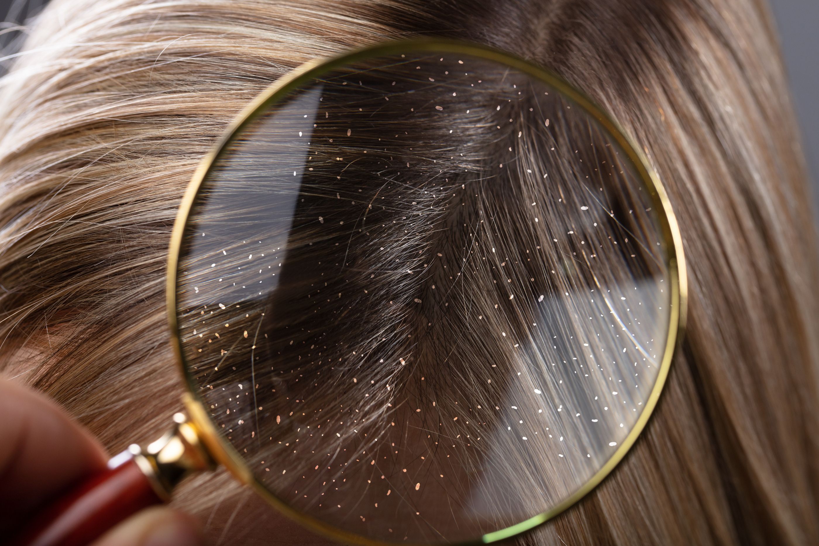 La piel, el pelo y las uñas, claves para detectar más de mil enfermedades