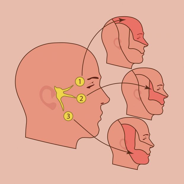 Neuralgia del trigémino, cuando un leve toque en la cara causa dolor 