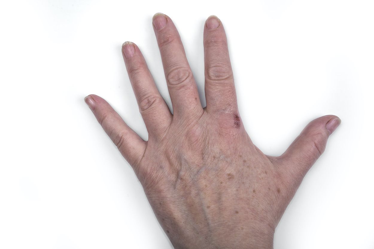 5 cremas de manos para eliminar las manchas