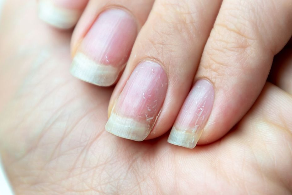 Llevar siempre las uñas pintadas puede ser perjudicial para su salud