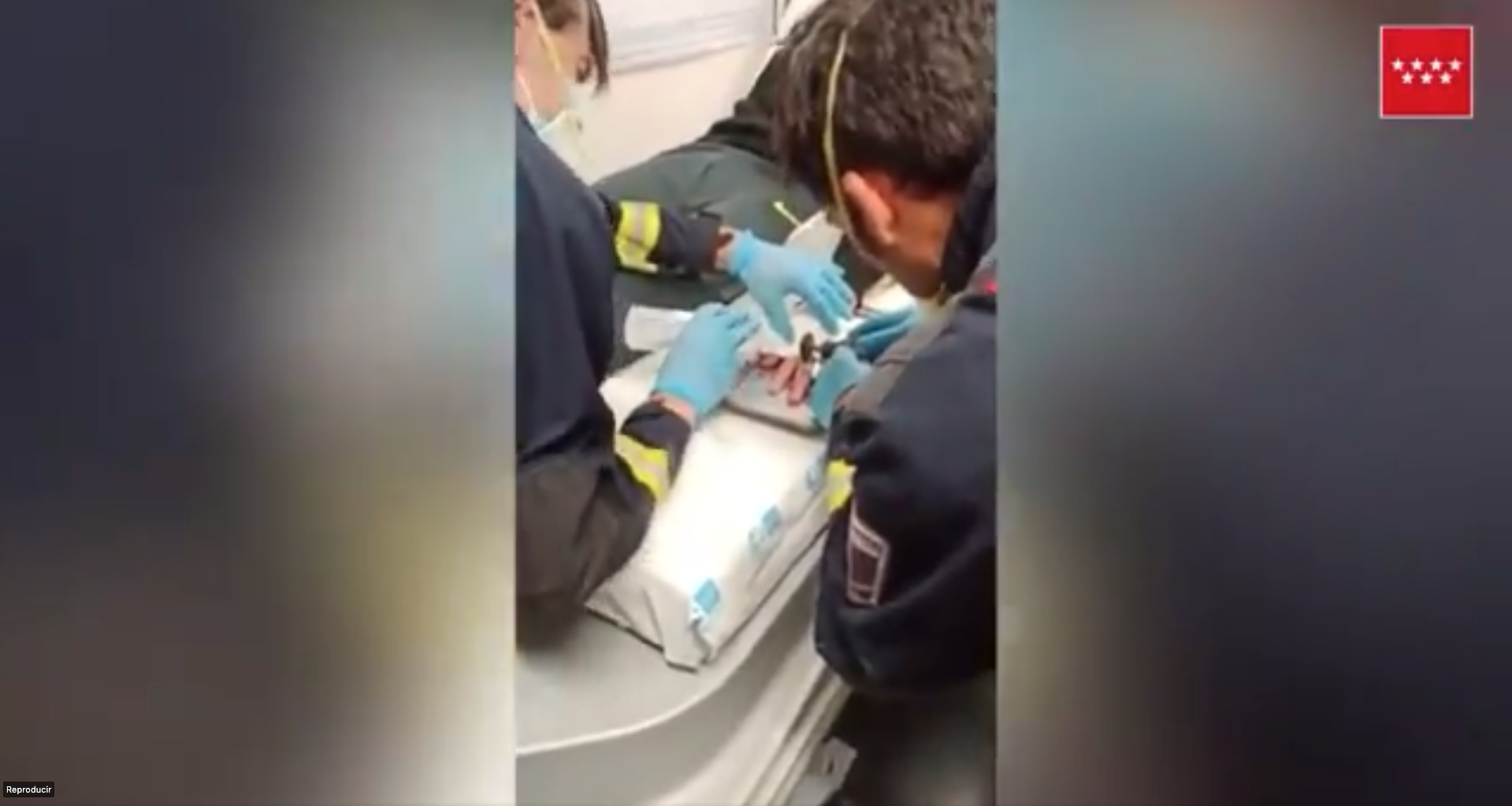 VÏDEO: Los bomberos consiguen quitar un anillo atascado en el dedo de un joven