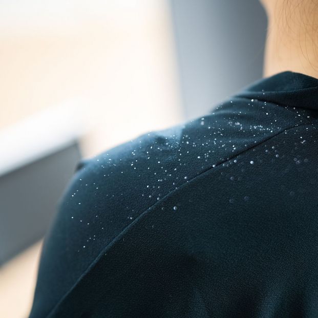 Si tienes caspa es que no conoces estos remedios naturales para evitarla Si tienes caspa es que no conoces estos remedios naturales para evitarla