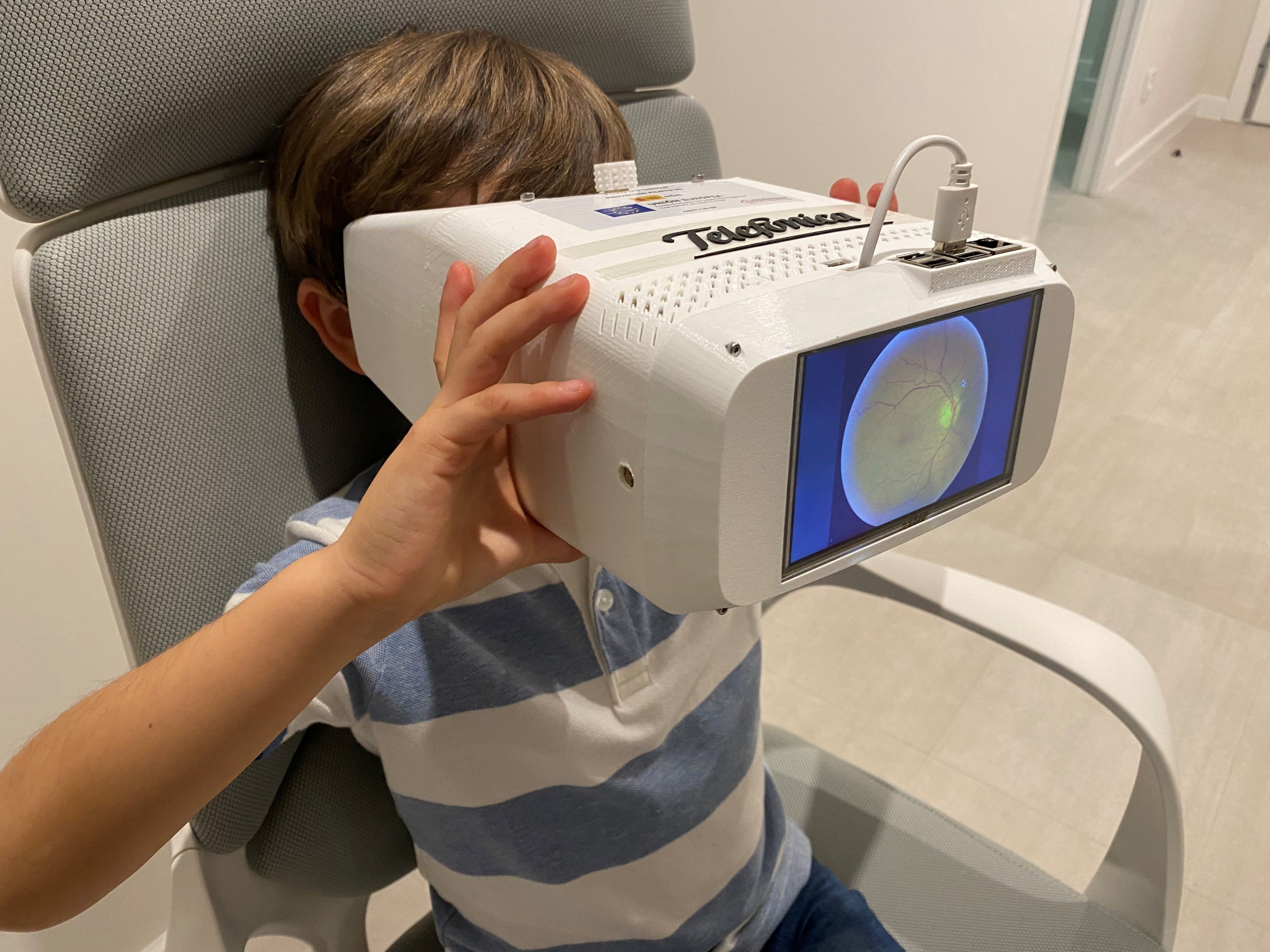 Telefónica revoluciona el diagnóstico oftalmológico con un nuevo dispositivo con 5G