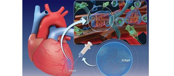 EuropaPress 3578703 inyeccion hidrogel puede promover curacion musculo cardiaco despues infarto EuropaPress 3578703 inyeccion hidrogel puede promover curacion musculo cardiaco despues infarto