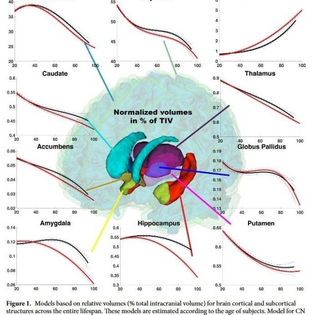 Imagen de la evolución del alzhéimer