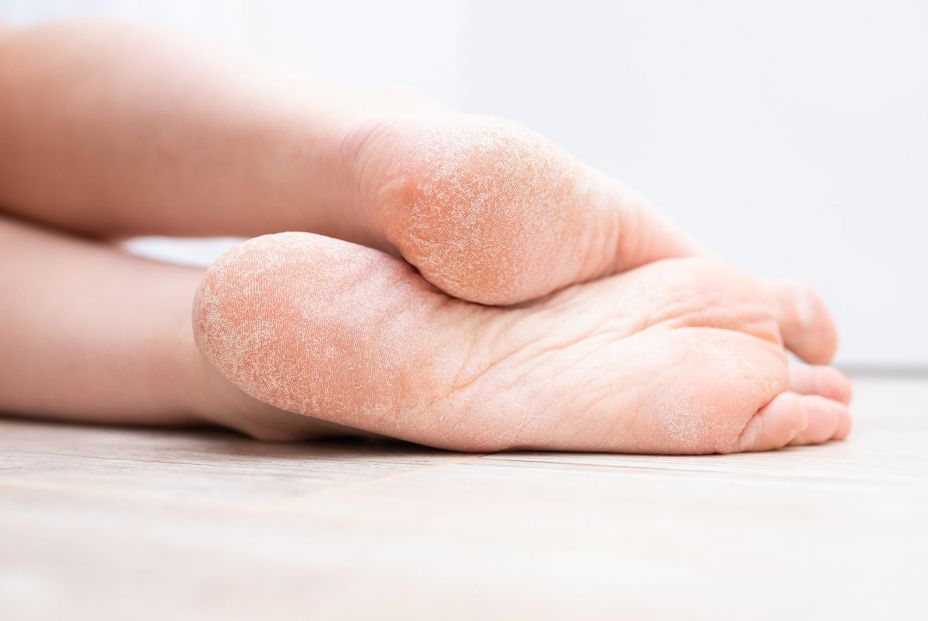 5 pasos para realizar una hidratación profunda de los pies