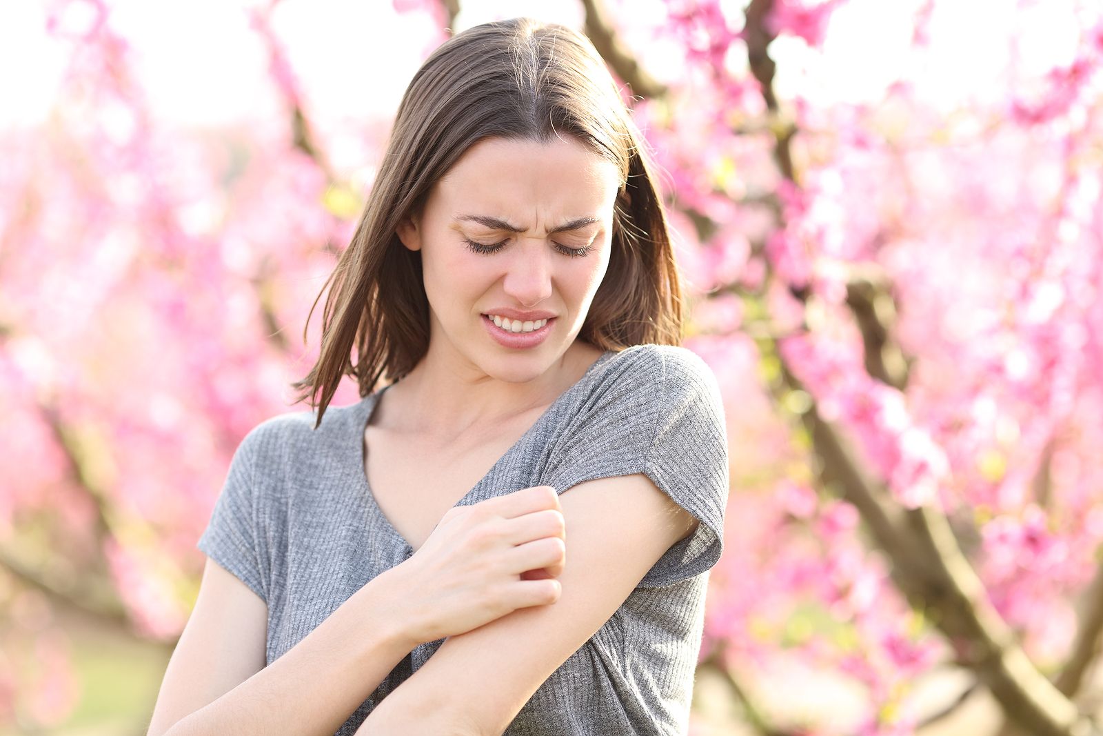 Aceite casero para aliviar las picaduras Foto: bigstock