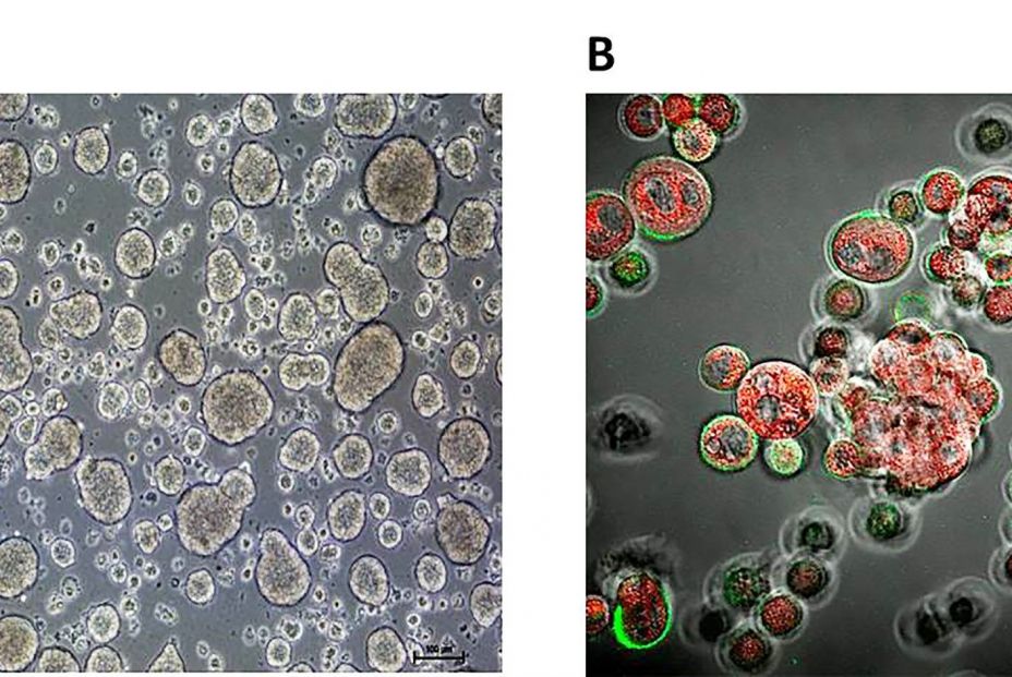 EuropaPress 3773513 disenan nanocapsulas aceite oliva inteligentes eficaces frente celulas