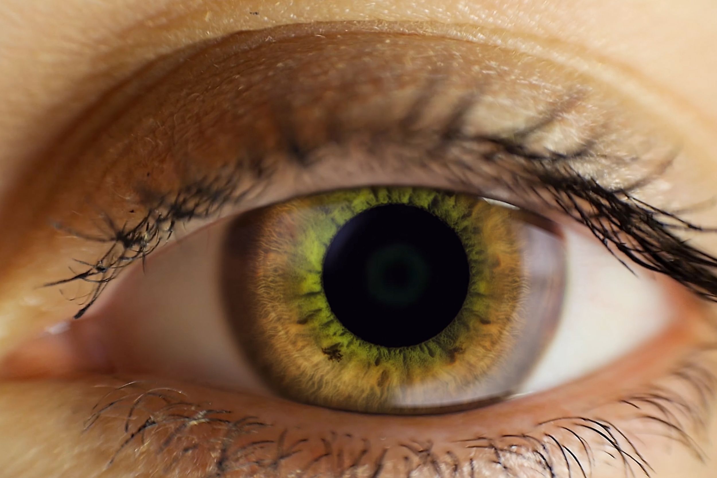 Melanoma ocular: Ojo humano (bigstock)