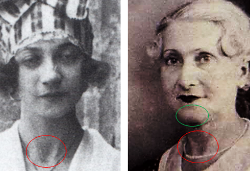 Yvonne (izquierda) en 1922 y Jeanne (derecha) en 1945