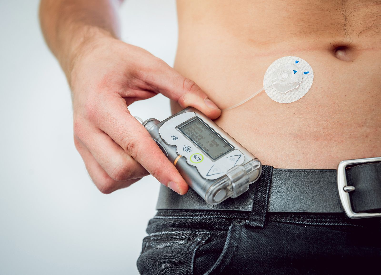 Las nuevas tecnologías permiten superar el miedo de los diabéticos a los episodios de hipoglucemia