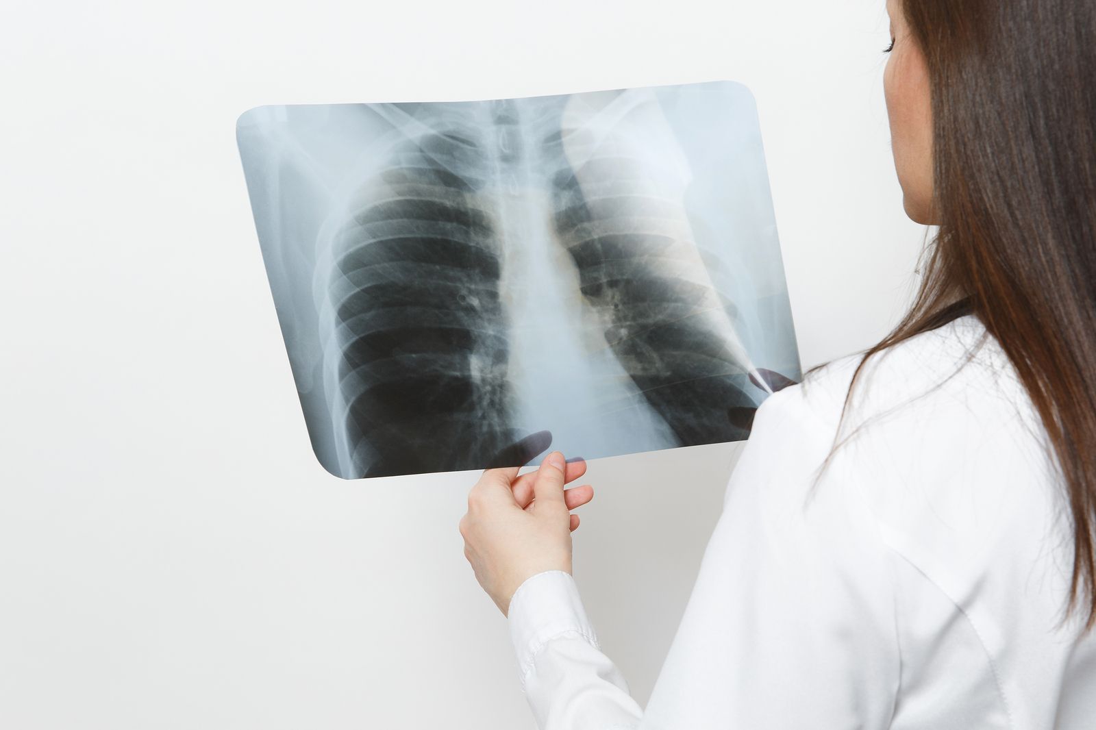 Enfermedades respiratorias (Bigstock)