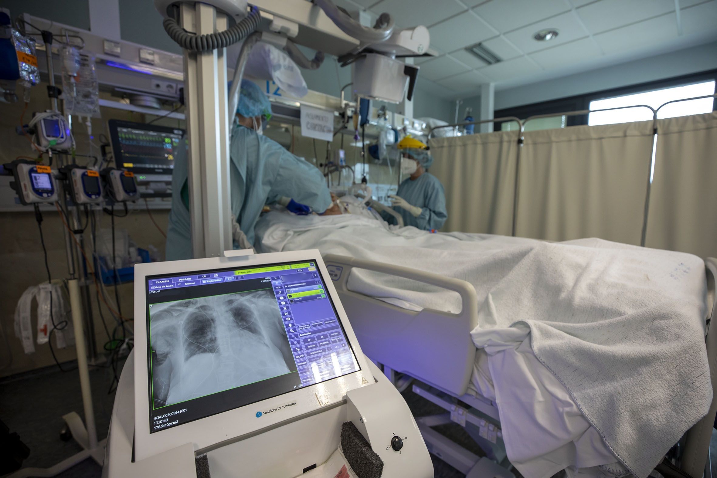 Los médicos rechazan el tratamiento con ozono frente a la COVID-19 por falta de evidencia científica. foto: Europa Press