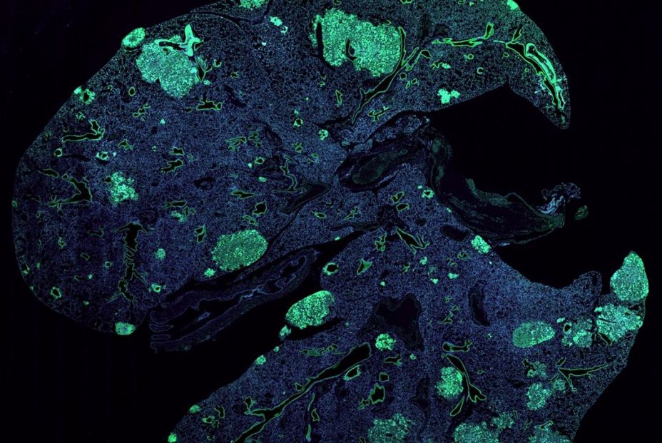 Investigadores del CSIC estudian uno de los mecanismos fundamentales de la metástasis. Foto: Europa Press