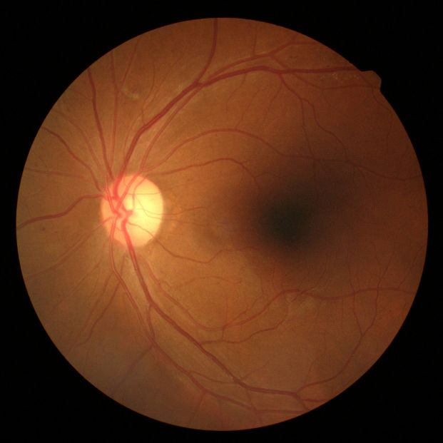 Retina (bigstock)
