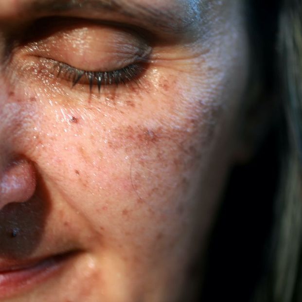 Adiós a las manchas solares con estos productos