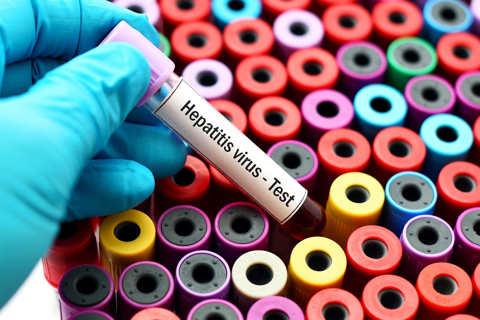 Hepatitis (bigstock)