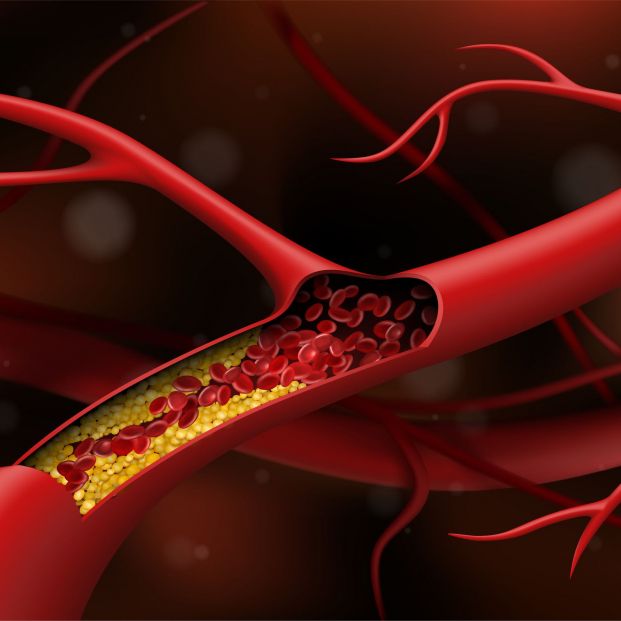 Estos son los riesgos de mantener el colesterol malo en niveles elevados durante mucho tiempo