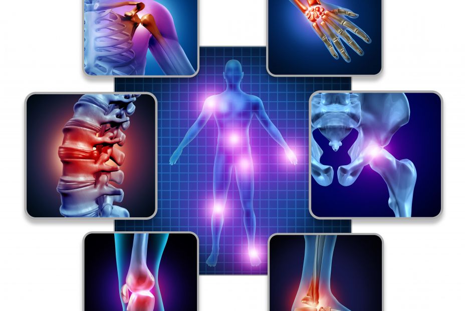 bigstock Human Body Joint Pain Concept  314219641