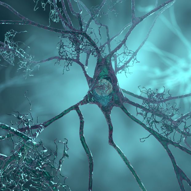 Un estudio español relaciona cambios en la materia blanca del cerebro con el avance del Alzheimer. Foto: Bigstock