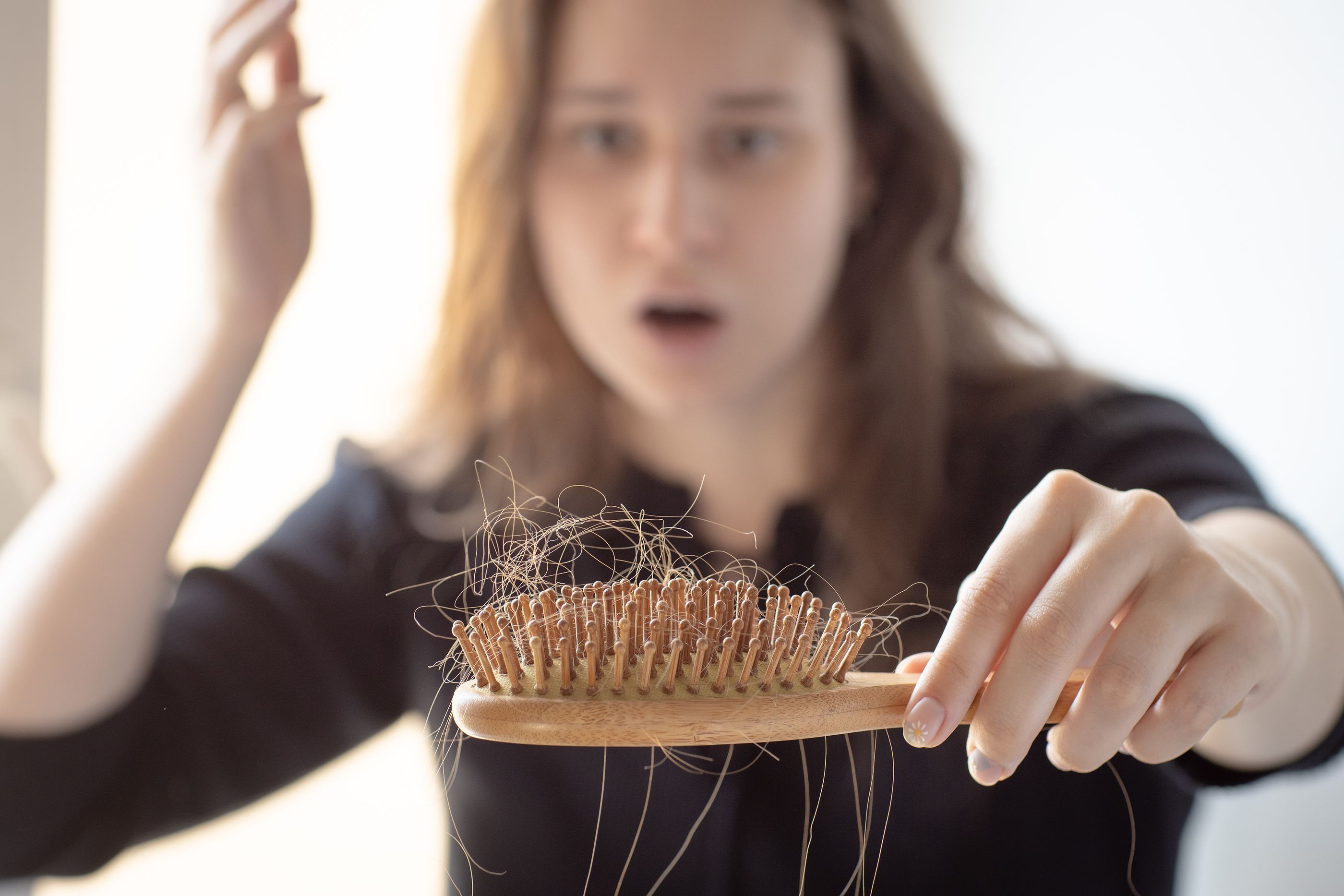 Apunta estos consejos para frenar la caída del pelo en otoño (Foto: Bigstock)
