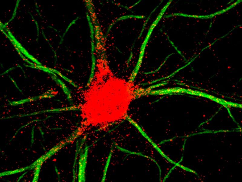 Predicen el comportamiento de conexiones neuronales para tratar enfermedades neurodegenerativas. Foto:Europa Press