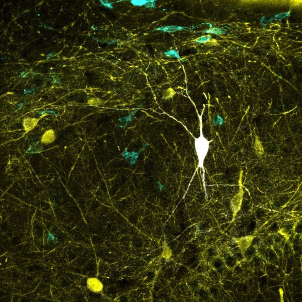 Predicen el comportamiento de conexiones neuronales para tratar enfermedades neurodegenerativas. Foto:Europa Press