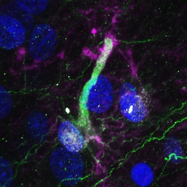 Este nuevo descubrimiento podría ser determinante para combatir el alzhéimer y el párkinson