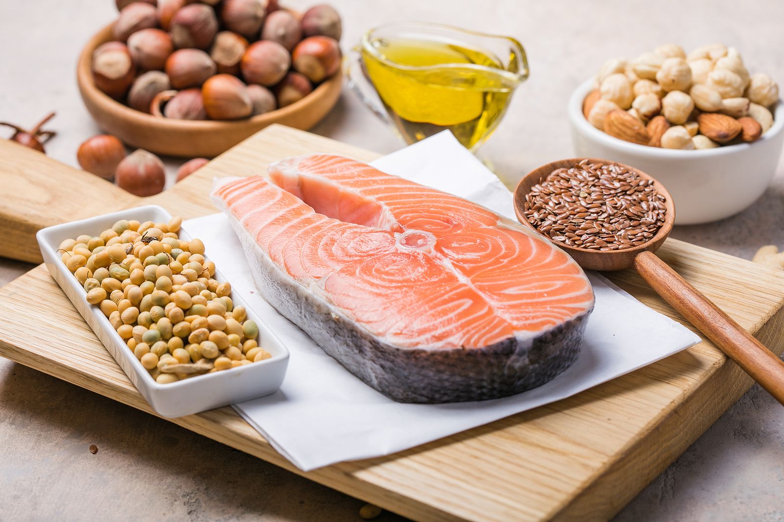 ¿Sufres de artrosis? Estos alimentos pueden ayudarte a reducir el dolor foto: bigstock