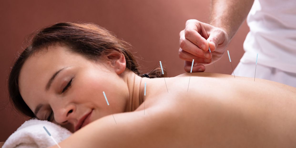 Diferencias entre la acupuntura y la punción seca
