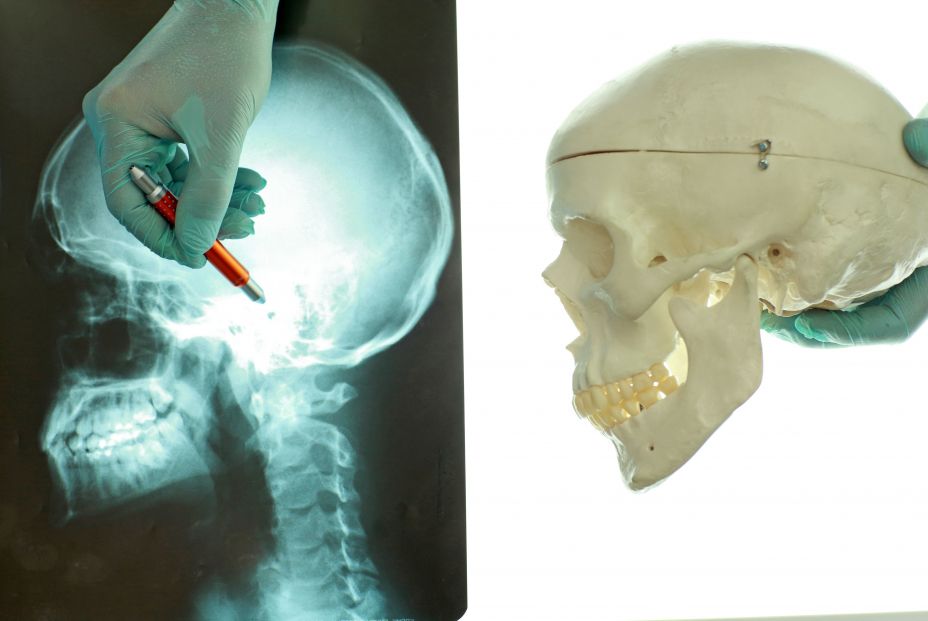 bigstock skull and neck at x ray film  244844947