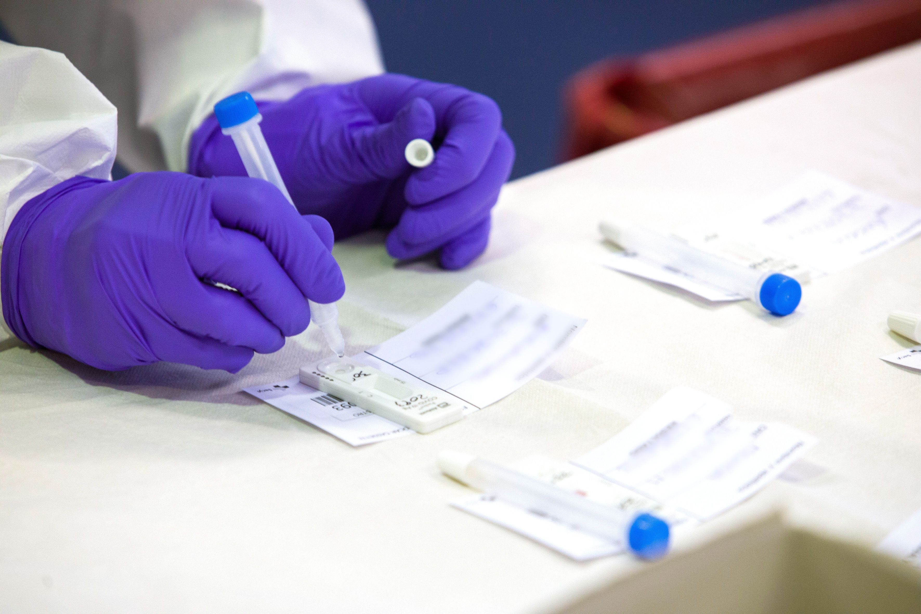 Alerta sanitaria: piden retirar esta marca de test de antígenos por falsos positivos