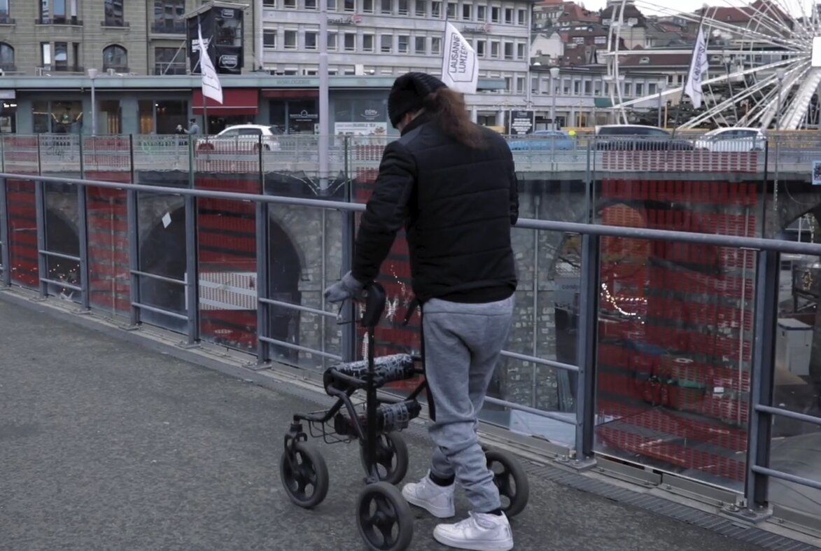 Tres parapléjicos vuelven a caminar un día después de recibir un implante electrónico