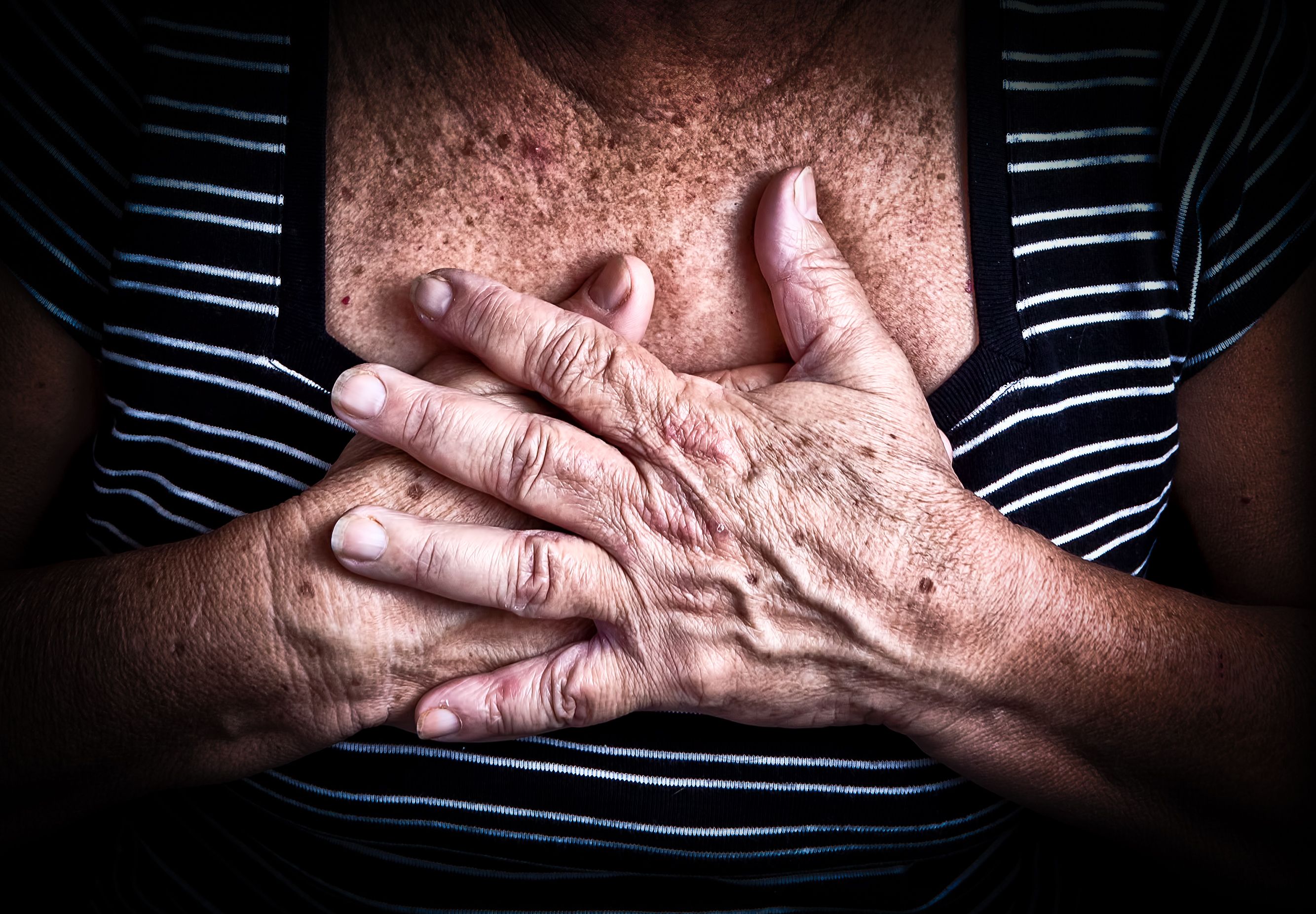 Las crisis hipertensivas pueden producir problemas cerebrales, cardiacos o microvasculares